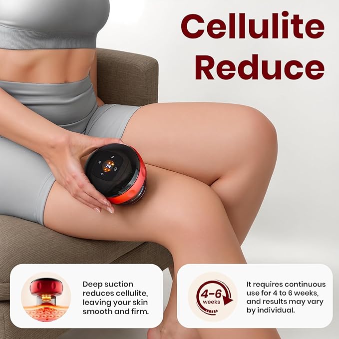 Rechargeable Vacuum Cupping Massage Anti Cellulite Magnet Therapy Wireless Guasha Scraping Fat Burner Slimming Body Scraping Cupping Hajama